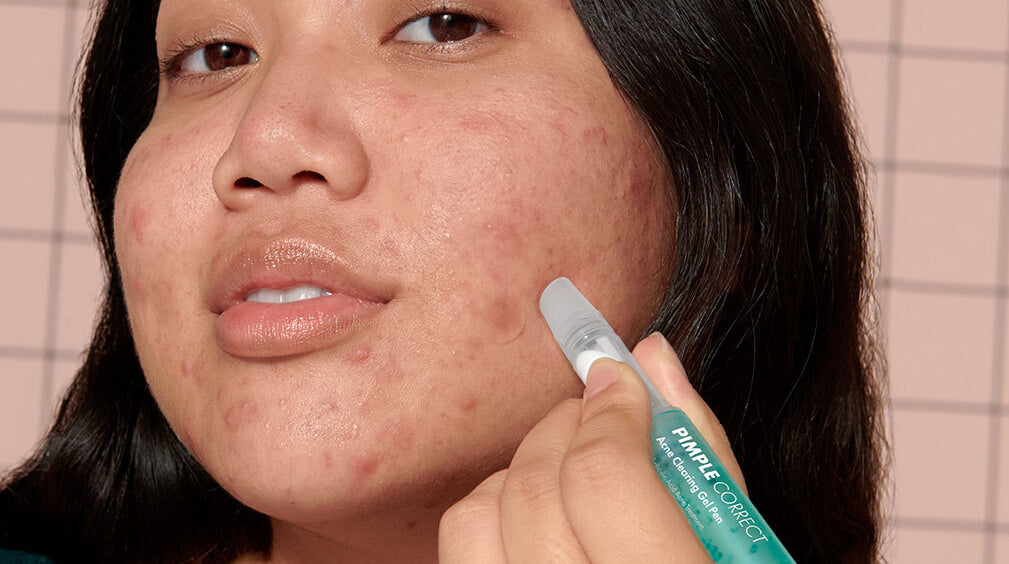 Hero Cosmetics' Mighty Patch Micropoint For Blemishes Patches Combine  Microneedling & Acne Care