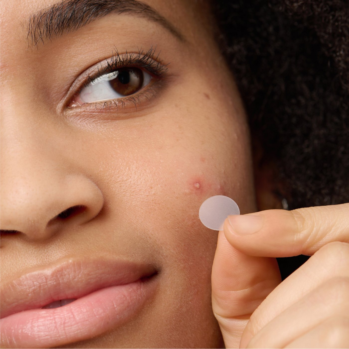 11 Best Pimple Patches